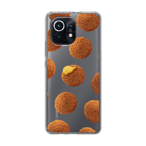 Bitterbalhoesje voor de Xiaomi Mi 11