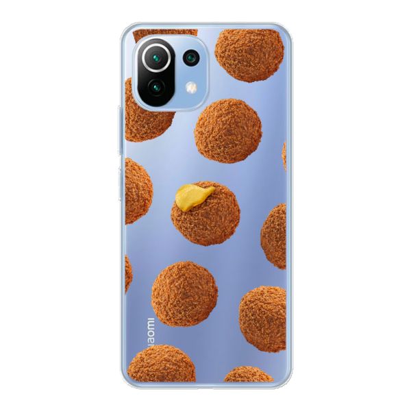 Bitterbalhoesje voor de Xiaomi Mi 11 Lite