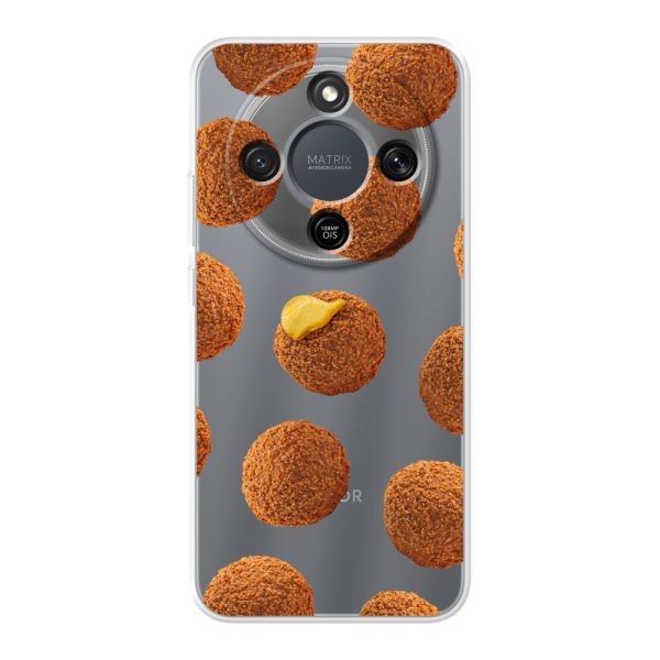 Bitterbalhoesje voor de Honor X9