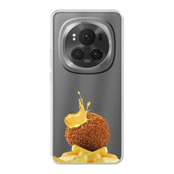 Flexibel Honor Magic6 Pro hoesje met Bitterbal, Friet en Mosterd
