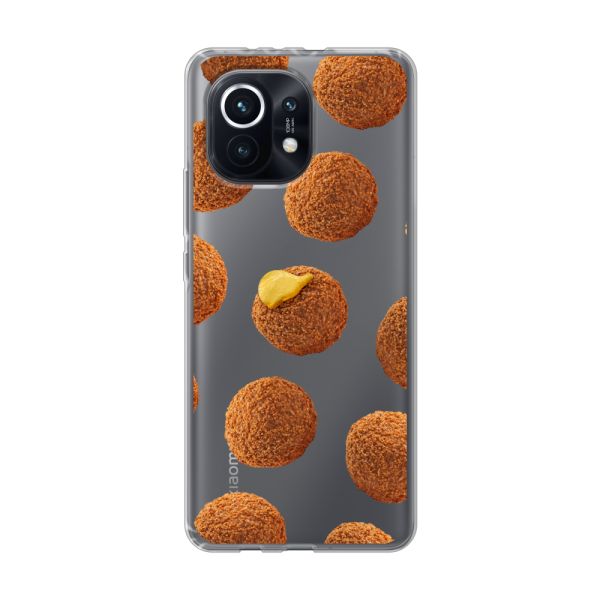 Bitterbalhoesje voor de Xiaomi Mi 11