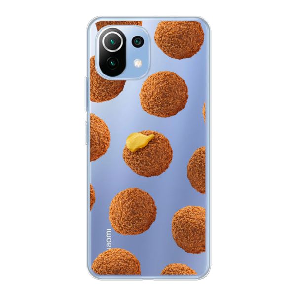 Bitterbalhoesje voor de Xiaomi Mi 11 Lite